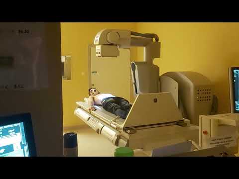 Medycyna po prostu - Odcinek 12 - RTG jamy brzusznej