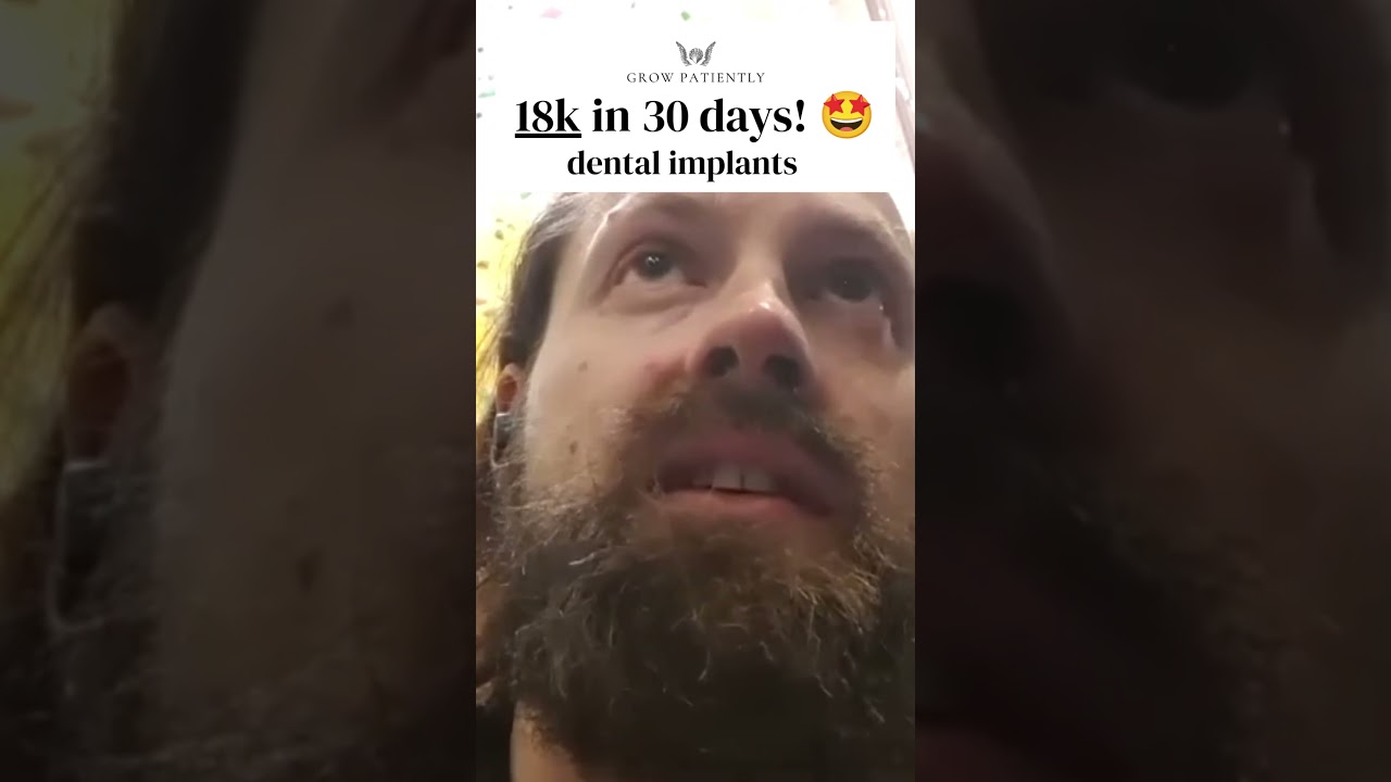 £18K in 30 Days from Dental Implants