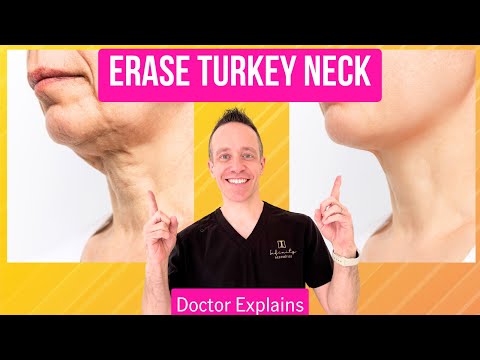 How to Get Rid of Turkey Neck: Complete Doctor's Guide 2024