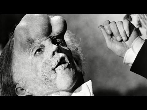 The TRUE 'Elephant Man' Story That Inspired The Whole World