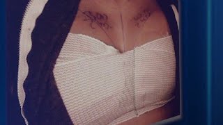 State investigating claims local plastic surgeon failed to treat infections, complications