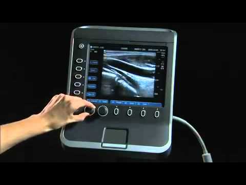 SonoSite Sシリーズ 製品トレーニング 第1部：システム概要 (SonoSite S Series Product Training Part 1: System Overview)