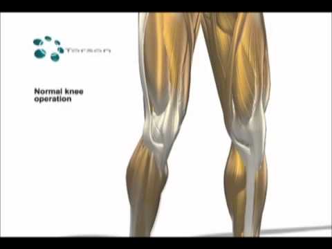 Per giunti sedano aglio limone Osteocondrosi in immagini