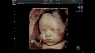 33 week baby opening eyes in the womb