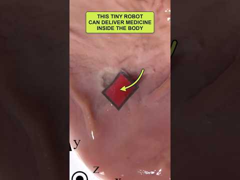 This Tiny Robot Could Deliver Medicine Exactly Where It's ...