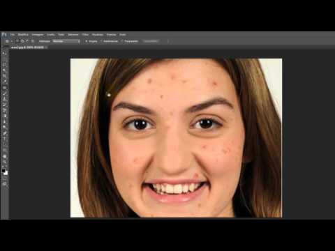 Il trucco a pigmentary nota su una faccia Crema da lentiggini per uomini