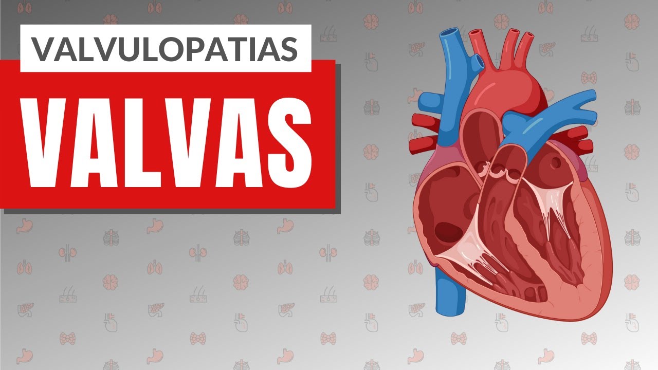 VALVULOPATIAS I PARTE 1: Valvas