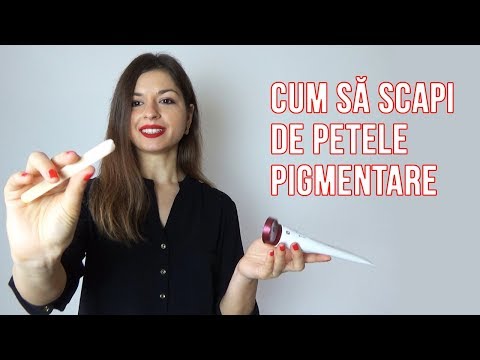 , title : '| CUM SA SCAPI DE PETELE PIGMENTARE | GIA Video Blog |'