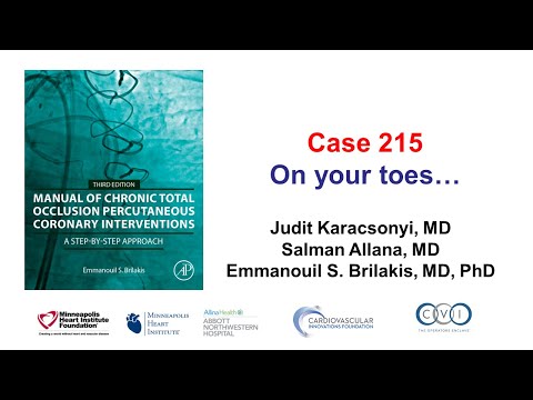 Case 215: Manual of CTO PCI - On your toes...