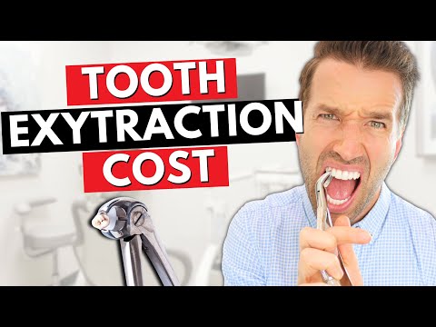 Cost of a Tooth Extraction | Teeth Extractions