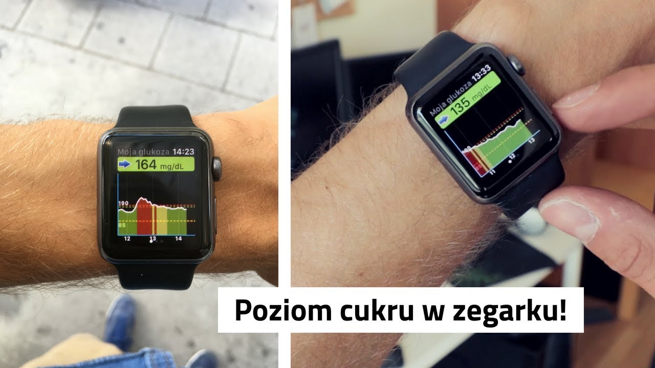 poziom CUKRU w ZEGARKU! #applewatch