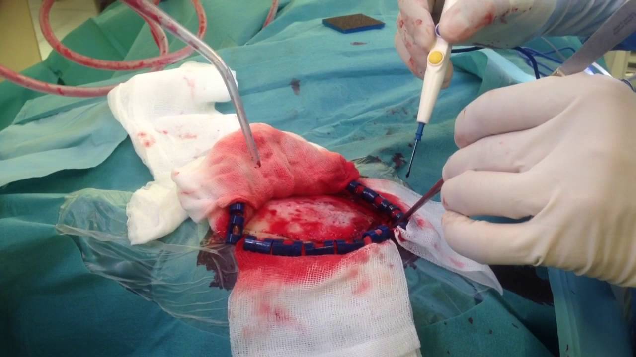 Juan Camilo Hernandez Acevedo-65