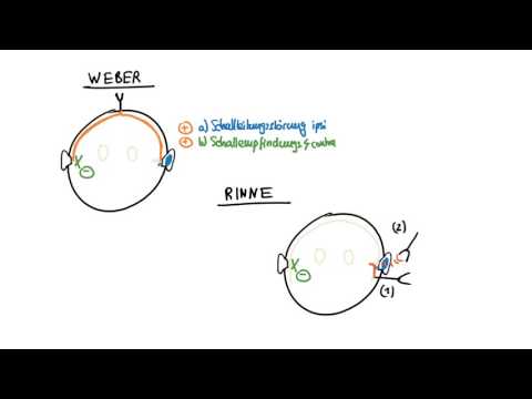 Weber und Rinne   Schallleitungsstörung vs  Schallempfindungsstörung