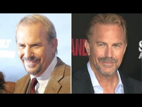 Balding and hair implants: Fact or fiction?