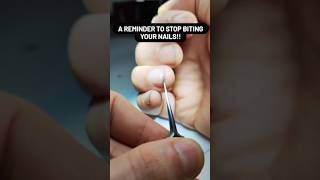 Dirty nails under the microscope | Nails Germs under microscope | Nails Germs 😱#shorts #microscope