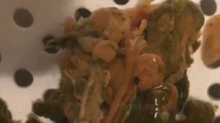 Massive Parasite in Body Extraction Through Colon Hydrotherapy to Heal & Detox Naturally