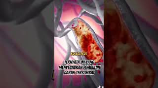 Download lagu Ternyata ini penyebab pembulu darah tersumbat #kolesterol #pembuluhdarah #jantung #tips #shorts mp3 Download lagu Ternyata ini penyebab pembulu darah tersumbat #kolesterol #pembuluhdarah #jantung #tips #shorts mp3
