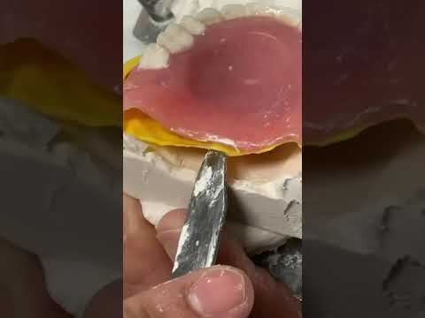 How to reline dentures!