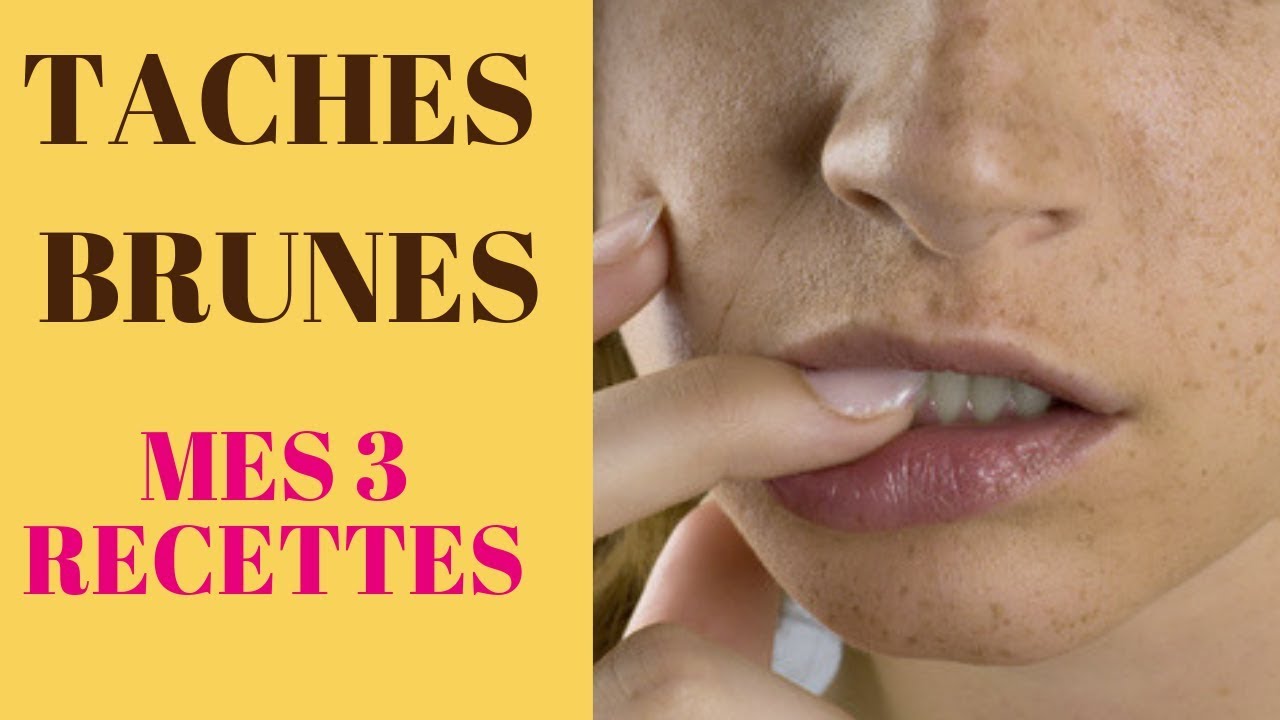 Se débarrasser des tâches brunes : 3 recettes simples.