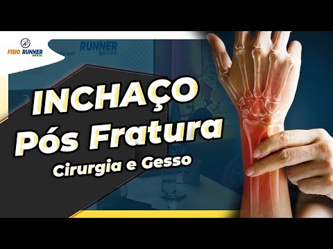 Como Diminuir as dores e os inchaços das Fraturas Pós cirurgia ou uso de gesso?