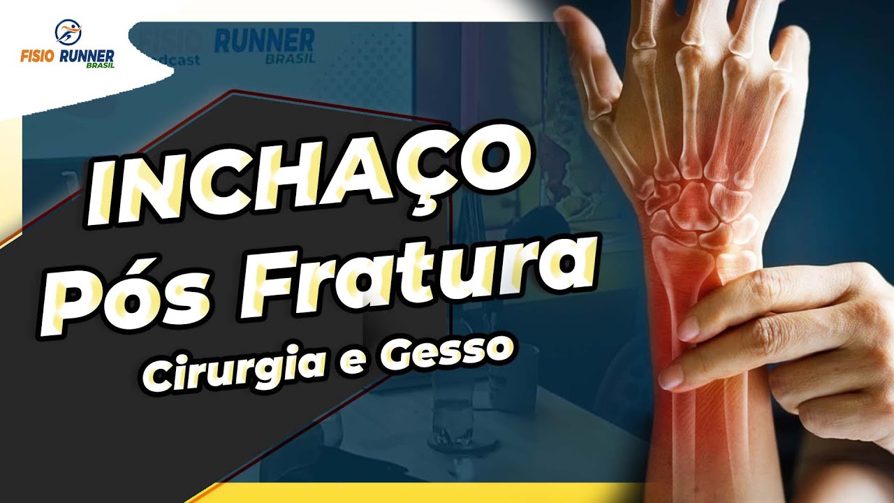 Como Diminuir as dores e os inchaços das Fraturas Pós cirurgia ou uso de gesso?