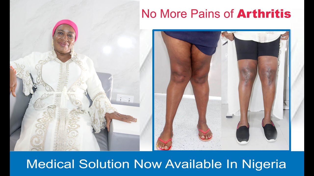 NO MORE PAINS OF ARTHRITIS.... SOLUTION NOW AVAILABLE IN NIGERIA thumbnail