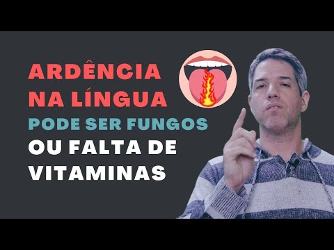 SÍNDROME DA ARDÊNCIA BUCAL - CAUSAS E TRATAMENTOS NATURAIS