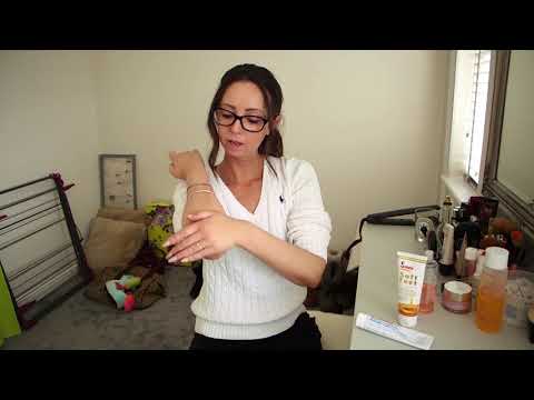 Chloe has scleroderma and talks about the impact on her life