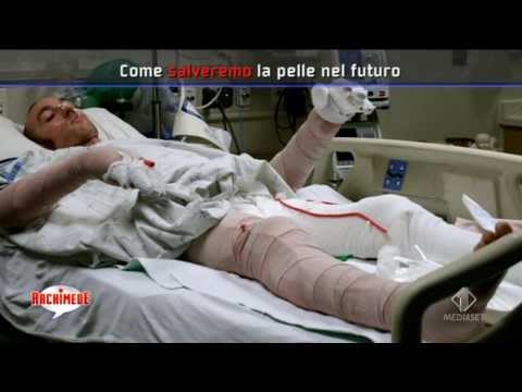 Rimedi di gente da lentiggini con un limone Se è possibile prendere il sole con lentiggini di faccia