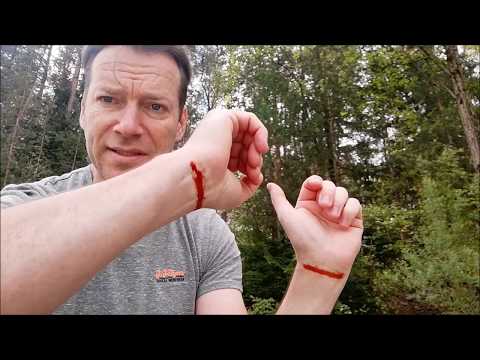 Jod ( Schilddrüse )selbst bestimmen? auf einen einfachen Weg!