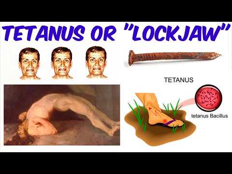 Tetanus - 