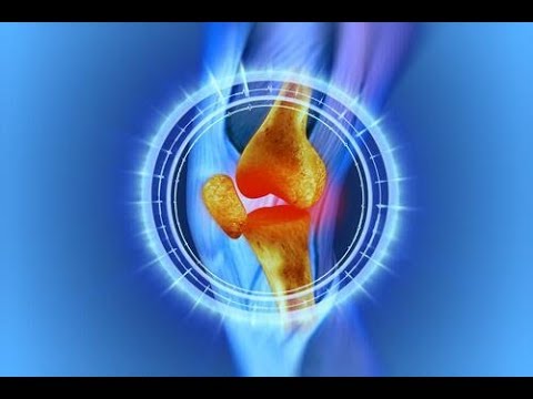 Ból kolana? Nie lekceważ tego objawu!