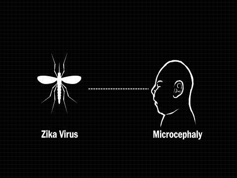 How the Zika virus affects an infant's brain