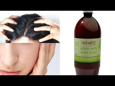 Top 5 ways to use amla juice/ benefits of amla juice in skin...