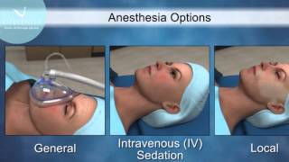 Mini lifting del viso