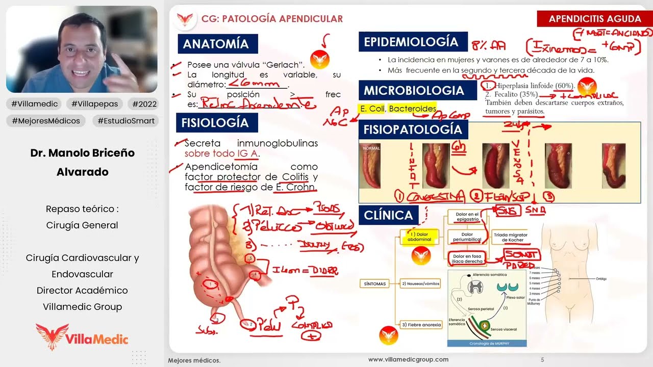 PATOLOGÍA APENDICULAR PARTE 1 - CIRUGÍA GENERAL - VILLAMEDIC