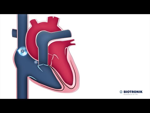 Electrical System of the Heart | Medical Animation