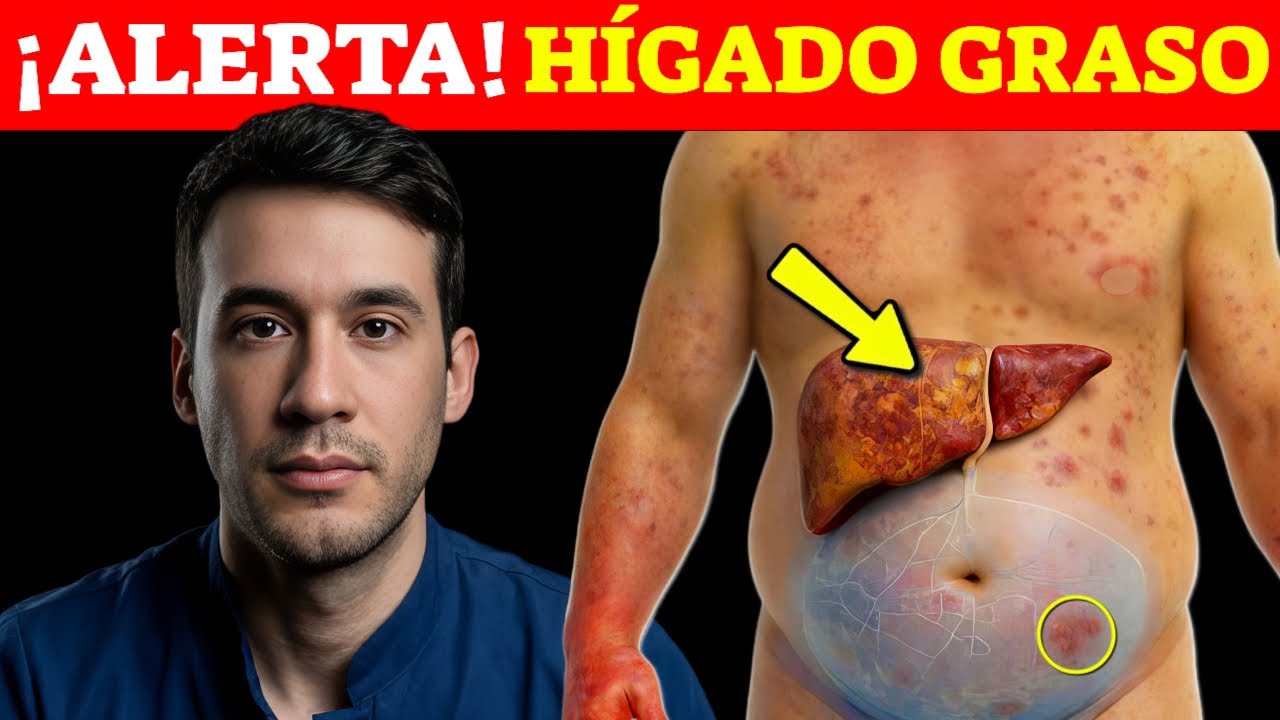 A SILENT THREAT! SIGNS THAT INDICATE FATTY LIVER| FIRST SYMPTOMS