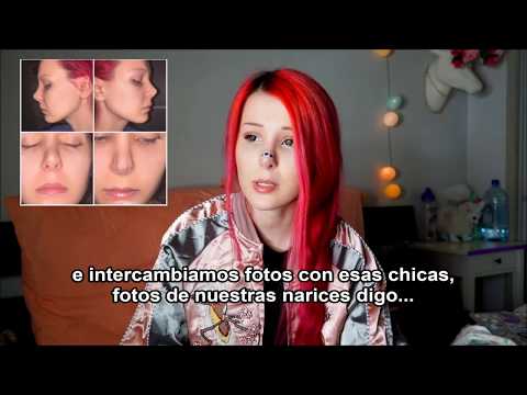 La Rinoplastia FALLIDA de Anastasiya Shpagina - SUB ESPAÑOL ❤ Anita