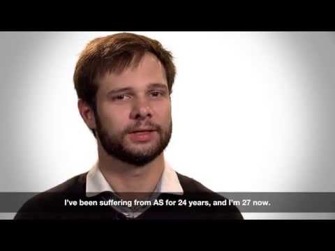 Living with ankylosing spondylitis: Pierre's perspective