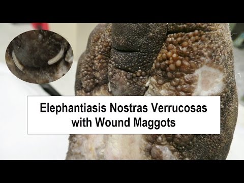 download lagu mp3 mp4 Maggots, download lagu Maggots gratis, unduh video klip Maggots