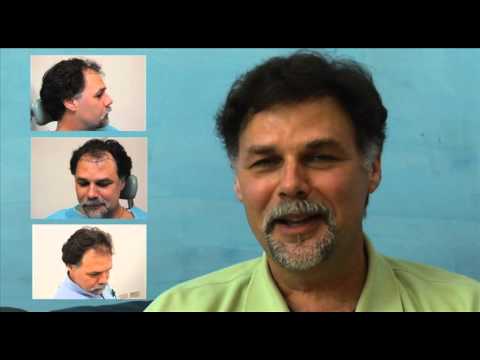 Hair Transplant in Dominican Republic with Dr. Alba Reyes