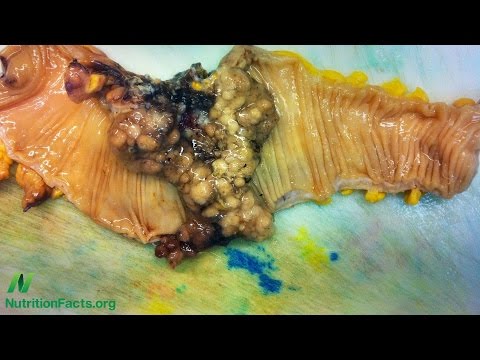 Breast Cancer Survival Vegetable