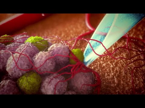 阿斯利康股價在390億美元的Alexion交易後下挫 (AstraZeneca shares dip after $39 bln Alexion deal)