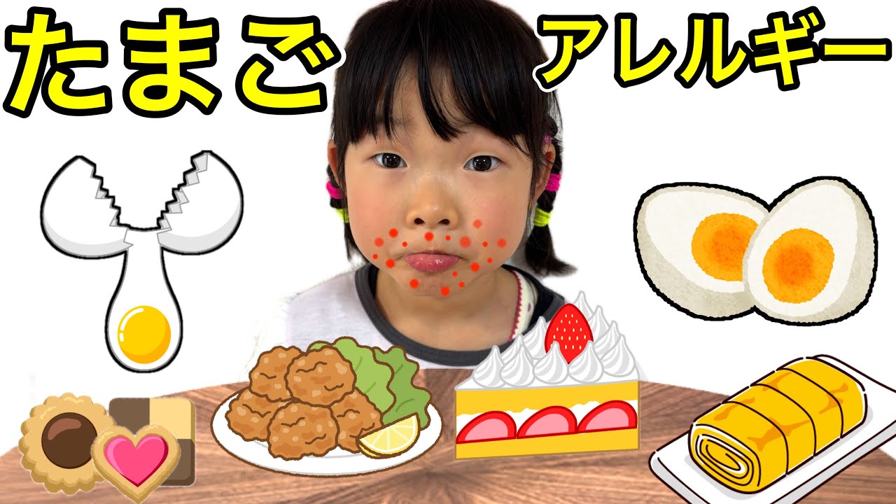 卵アレルギーのここちゃんが卵入りのお菓子に挑戦したらこうなりました・・・・・・😭😭😭