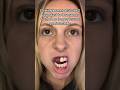 Can Braces Make Your Teeth FALL OUT