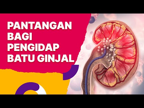 How to Treat Kidney Stones