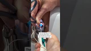 This is how an IUD is inserted