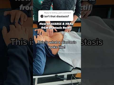 How to HEAL & Assess DIASTASIS Recti at Home! #health #education #mom #exercise #diastasis #fyp