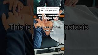 How to HEAL & Assess DIASTASIS Recti at Home! #health #education #mom #exercise #diastasis #fyp